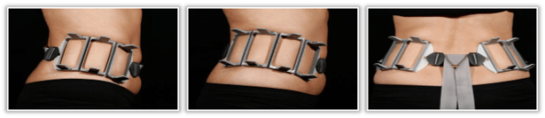 Treatment frames love handles.png